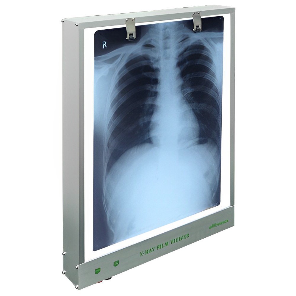 X-Ray Viewer